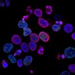maladies auto-immunes
